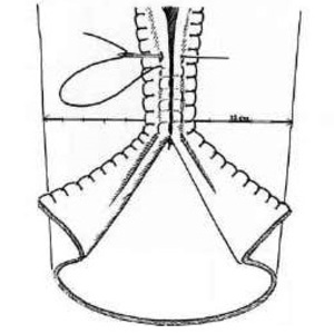 Seam diagram of the Thorsberg tunic; a technical illustration of its construction.