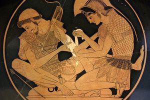 Achilles bandages the wounded Patroclus. Both figures were wearing linothorax plates reinforced with scales,and Patroclus ' untied left shoulder pad straightened up. Image from a red-figure vase from Vulci,circa 500 BC.